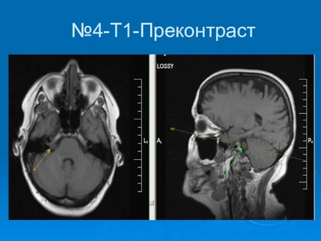 №4-Т1-Преконтраст