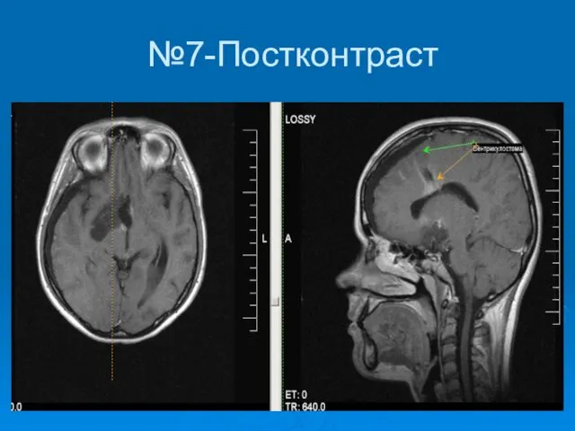 №7-Постконтраст