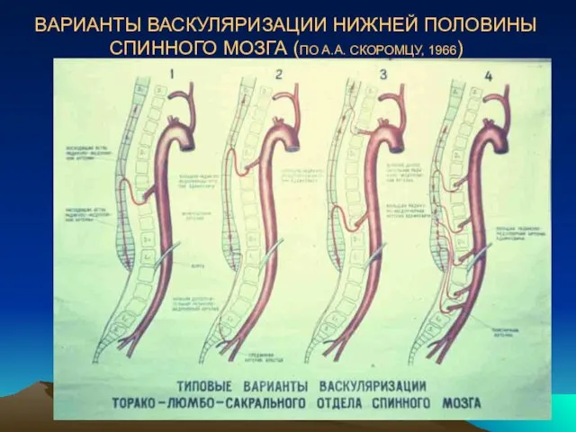 ВАРИАНТЫ ВАСКУЛЯРИЗАЦИИ НИЖНЕЙ ПОЛОВИНЫ СПИННОГО МОЗГА (ПО А.А. СКОРОМЦУ, 1966)