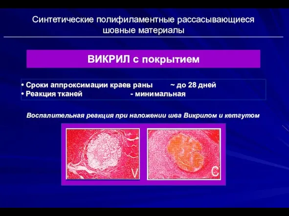 Синтетические полифиламентные рассасывающиеся шовные материалы ВИКРИЛ с покрытием Сроки аппроксимации краев