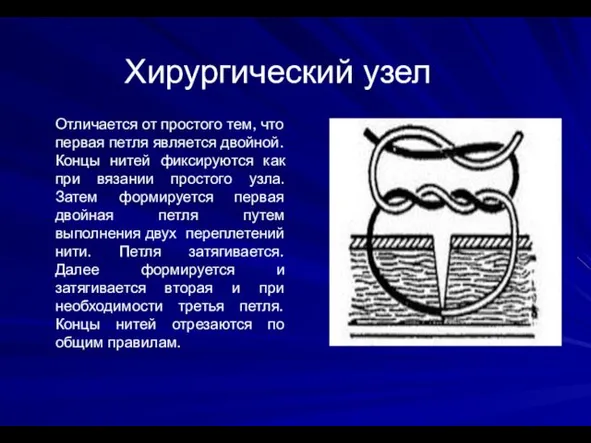 Хирургический узел Отличается от простого тем, что первая петля является двойной.