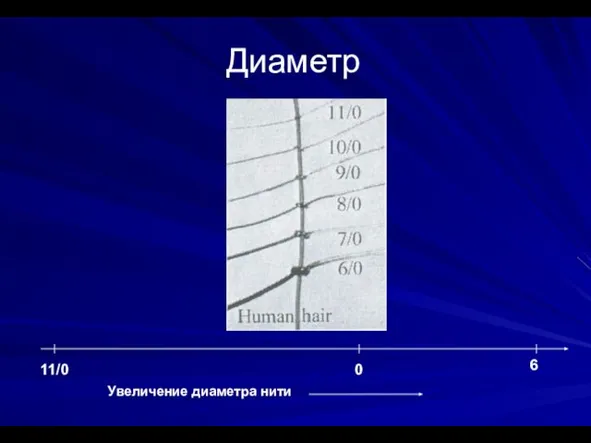 Диаметр 11/0 6 0 Увеличение диаметра нити