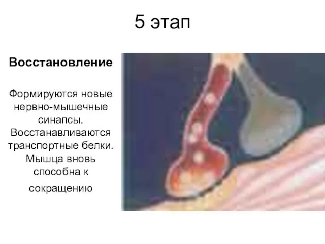 5 этап Восстановление Формируются новые нервно-мышечные синапсы. Восстанавливаются транспортные белки. Мышца вновь способна к сокращению