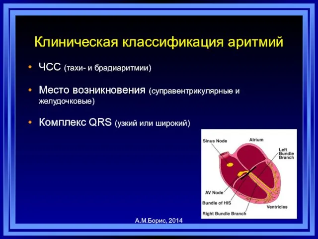 Клиническая классификация аритмий ЧСС (тахи- и брадиаритмии) Место возникновения (суправентрикулярные и