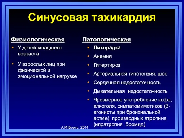 Синусовая тахикардия Физиологическая У детей младшего возраста У взрослых лиц при