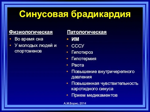 Синусовая брадикардия Физиологическая Во время сна У молодых людей и спортсменов