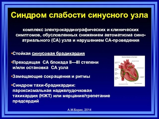 Синдром слабости синусного узла комплекс электрокардиографических и клинических симптомов, обусловленных снижением