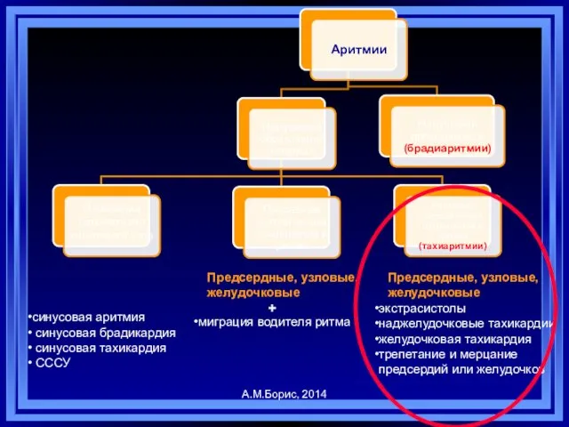 синусовая аритмия синусовая брадикардия синусовая тахикардия СССУ миграция водителя ритма Предсердные,