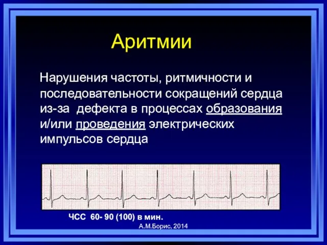 Аритмии Нарушения частоты, ритмичности и последовательности сокращений сердца из-за дефекта в