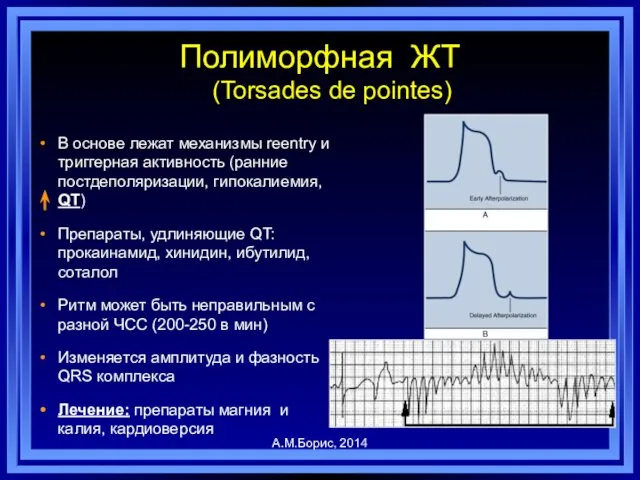 Полиморфная ЖТ (Torsades de pointes) В основе лежат механизмы reentry и