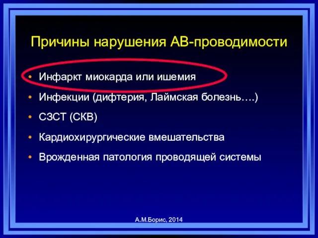 Причины нарушения АВ-проводимости Инфаркт миокарда или ишемия Инфекции (дифтерия, Лаймская болезнь….)