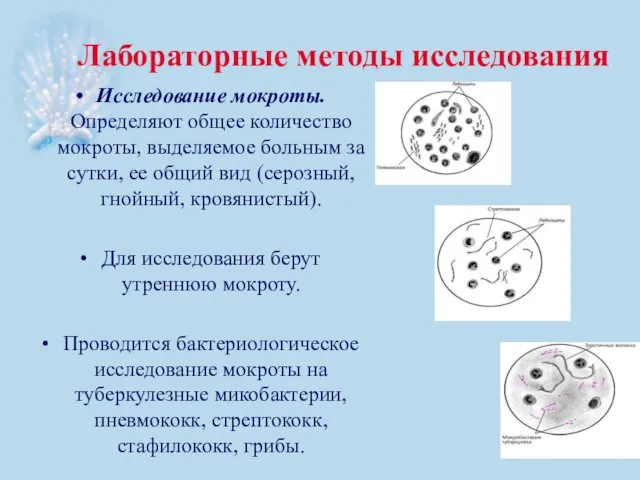 Лабораторные методы исследования Исследование мокроты. Определяют общее количество мокроты, выделяемое больным