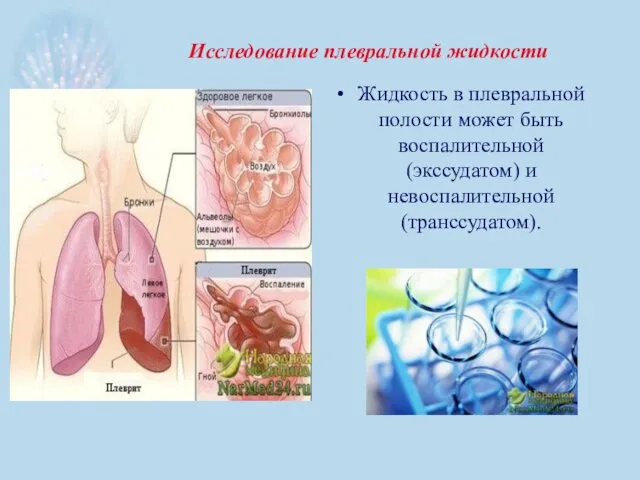 Исследование плевральной жидкости Жидкость в плевральной полости может быть воспалительной (экссудатом) и невоспалительной (транссудатом).