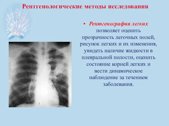 Рентгенологические методы исследования Рентгенография легких позволяет оценить прозрачность легочных полей, рисунок