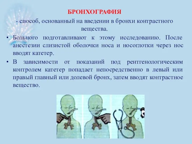 БРОНХОГРАФИЯ - способ, основанный на введении в бронхи контрастного вещества. Больного