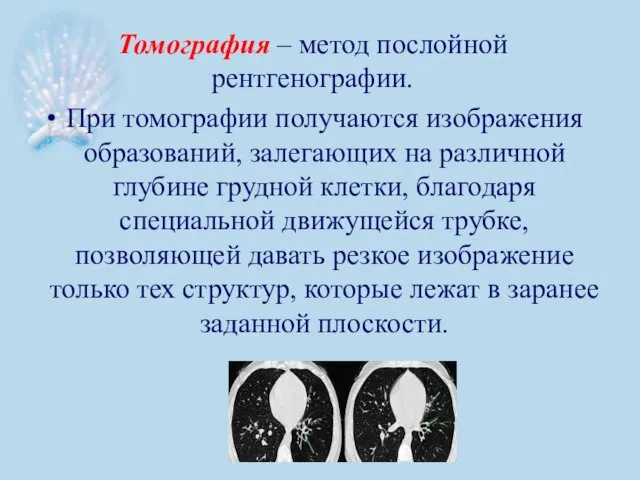 Томография – метод послойной рентгенографии. При томографии получаются изображения образований, залегающих