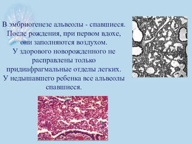 В эмбриогенезе альвеолы - спавшиеся. После рождения, при первом вдохе, они