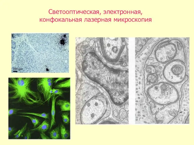 Светооптическая, электронная, конфокальная лазерная микроскопия