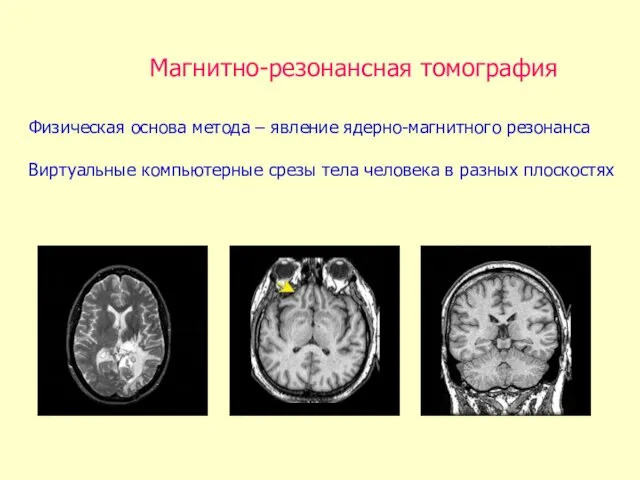 Магнитно-резонансная томография Физическая основа метода – явление ядерно-магнитного резонанса Виртуальные компьютерные