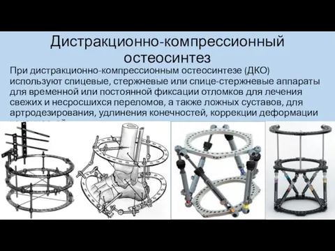 Дистракционно-компрессионный остеосинтез При дистракционно-компрессионным остеосинтезе (ДКО) используют спицевые, стержневые или спице-стержневые