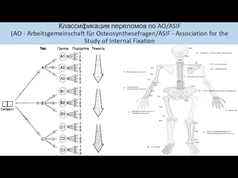 Классификация переломов по AO/ASIF (AO - Arbeitsgemeinschaft für Osteosynthesefragen/ASIF - Association