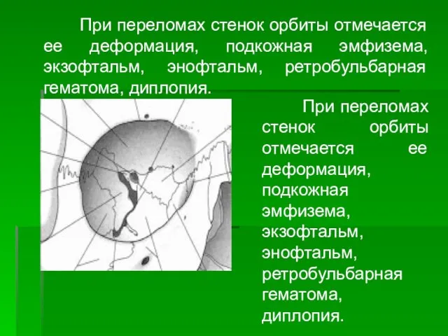 При переломах стенок орбиты отмечается ее деформация, подкожная эмфизема, экзофтальм, энофтальм,