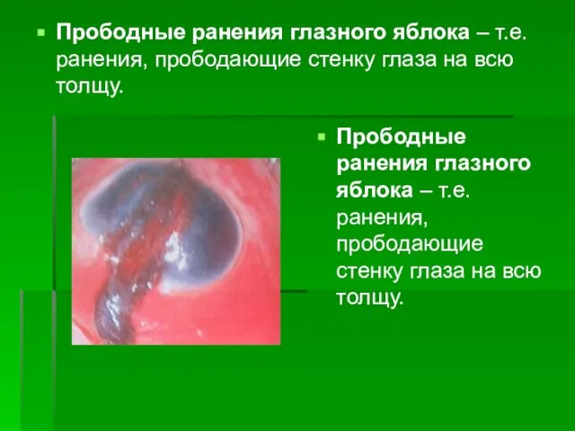 Прободные ранения глазного яблока – т.е. ранения, прободающие стенку глаза на