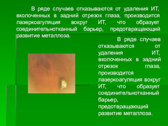 В ряде случаев отказываются от удаления ИТ, вколоченных в задний отрезок