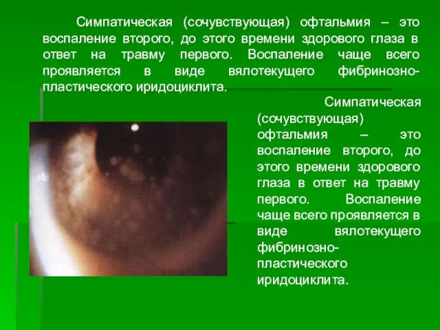 Симпатическая (сочувствующая) офтальмия – это воспаление второго, до этого времени здорового