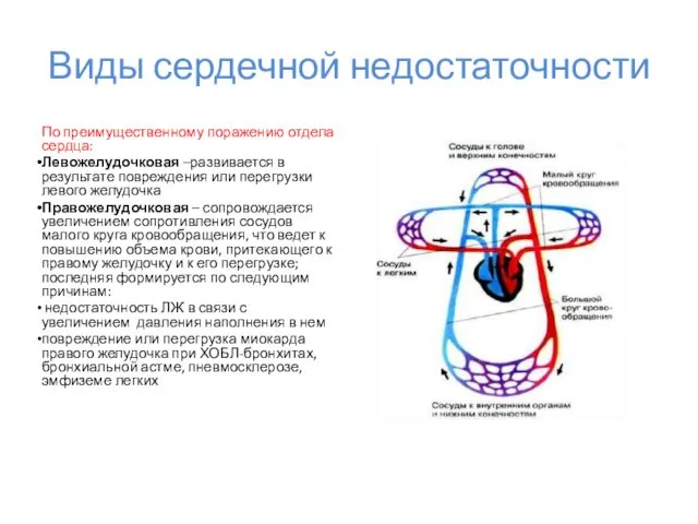 Виды сердечной недостаточности По преимущественному поражению отдела сердца: Левожелудочковая –развивается в