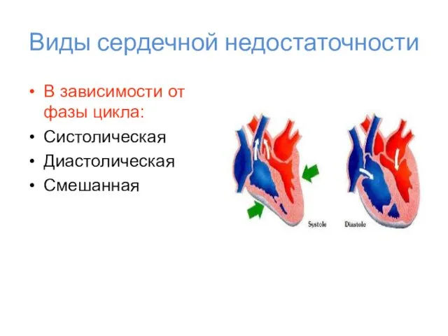 Виды сердечной недостаточности В зависимости от фазы цикла: Систолическая Диастолическая Смешанная