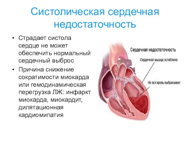 Систолическая сердечная недостаточность Страдает систола сердце не может обеспечить нормальный сердечный