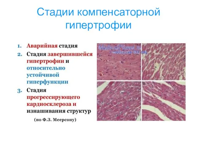 Стадии компенсаторной гипертрофии