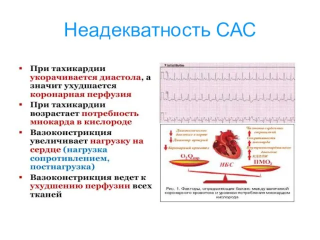 Неадекватность САС