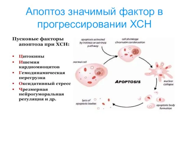 Апоптоз значимый фактор в прогрессировании ХСН