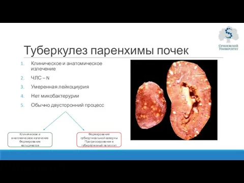 Туберкулез паренхимы почек Клиническое и анатомическое излечение ЧЛС – N Умеренная