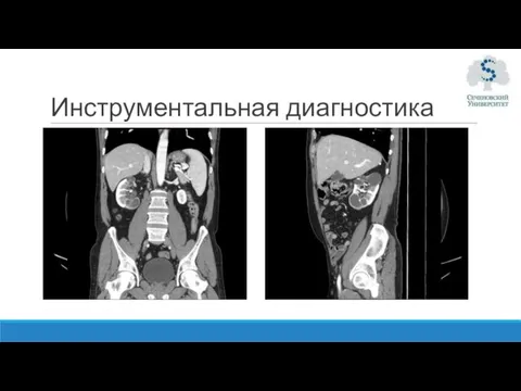 Инструментальная диагностика