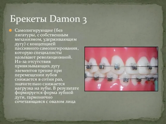 Брекеты Damon 3 Самолигирующие (без лигатуры, с собственным механизмом, удерживающим дугу)