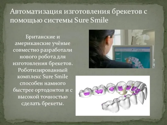 Автоматизация изготовления брекетов с помощью системы Sure Smile Британские и американские