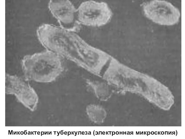 Микобактерии туберкулеза (электронная микроскопия)