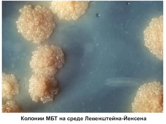 Колонии МБТ на среде Левенштейна-Йенсена