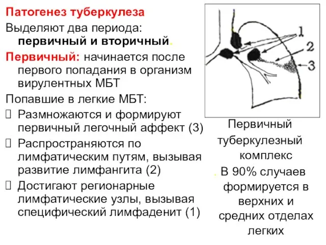 Патогенез туберкулеза Выделяют два периода: первичный и вторичный. Первичный: начинается после