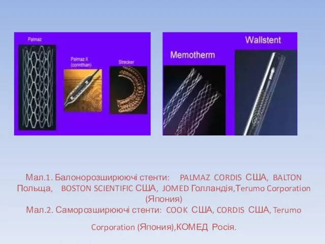 Мал.1. Балонорозширюючі стенти: PALMAZ CORDIS США, BALTON Польща, BOSTON SCIENTIFIC США,