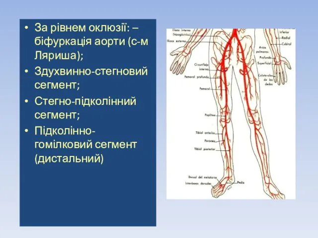 За рівнем оклюзії: –біфуркація аорти (с-м Ляриша); Здухвинно-стегновий сегмент; Стегно-підколінний сегмент; Підколінно-гомілковий сегмент (дистальний)