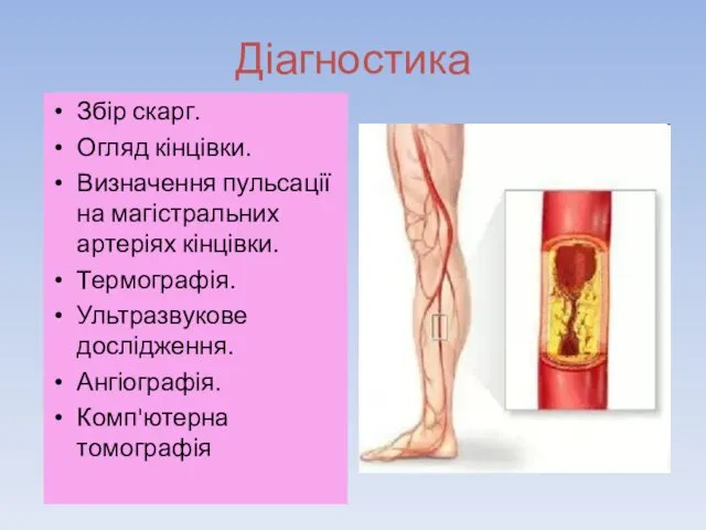 Діагностика Збір скарг. Огляд кінцівки. Визначення пульсації на магістральних артеріях кінцівки.