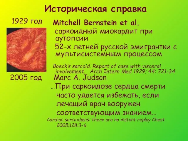 Историческая справка 1929 год Mitchell Bernstein et al. саркоидный миокардит при