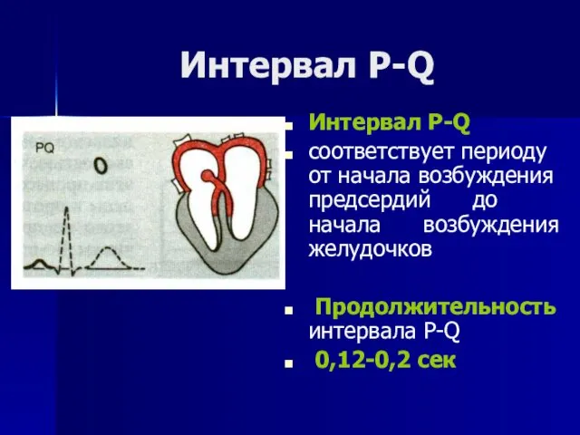 Интервал Р-Q Интервал Р-Q соответствует периоду от начала возбуждения предсердий до