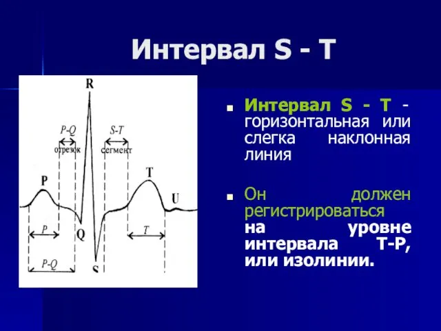 Интервал S - Т Интервал S - Т - горизонтальная или