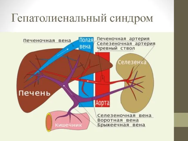 Гепатолиенальный синдром