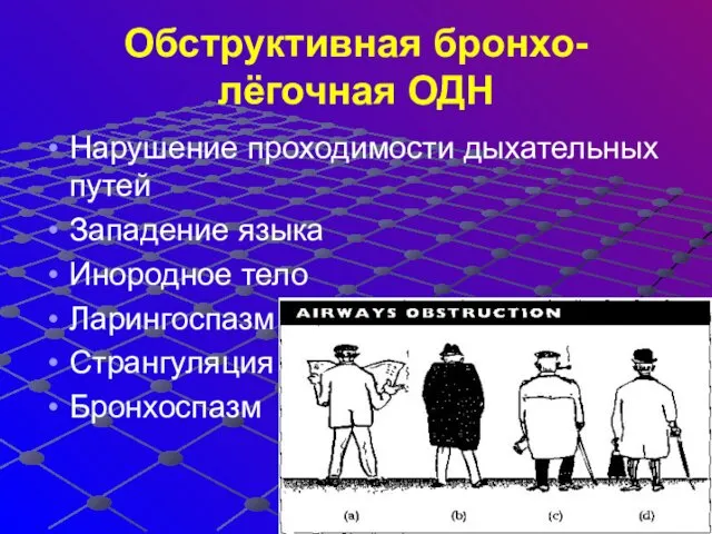 Обструктивная бронхо-лёгочная ОДН Нарушение проходимости дыхательных путей Западение языка Инородное тело Ларингоспазм Странгуляция Бронхоспазм